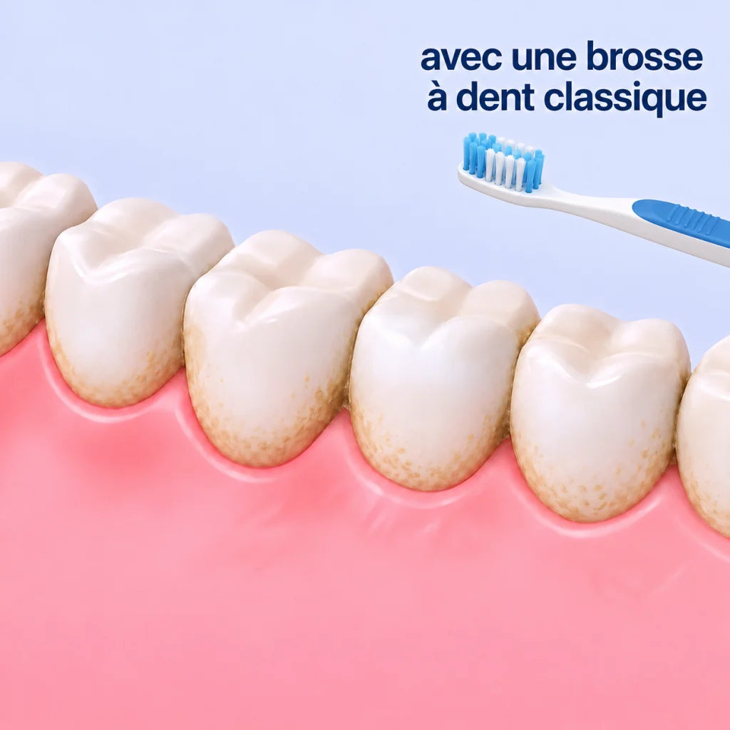 Dents jaunies par des taches de surface malgré un brossage classique